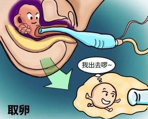 人工取卵的全部过程 人工取卵对人的伤害大吗